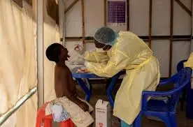 Lonjakan Kasus Mpox di Afrika, DRC Menjadi Pusat Wabah (Ilustrasi)